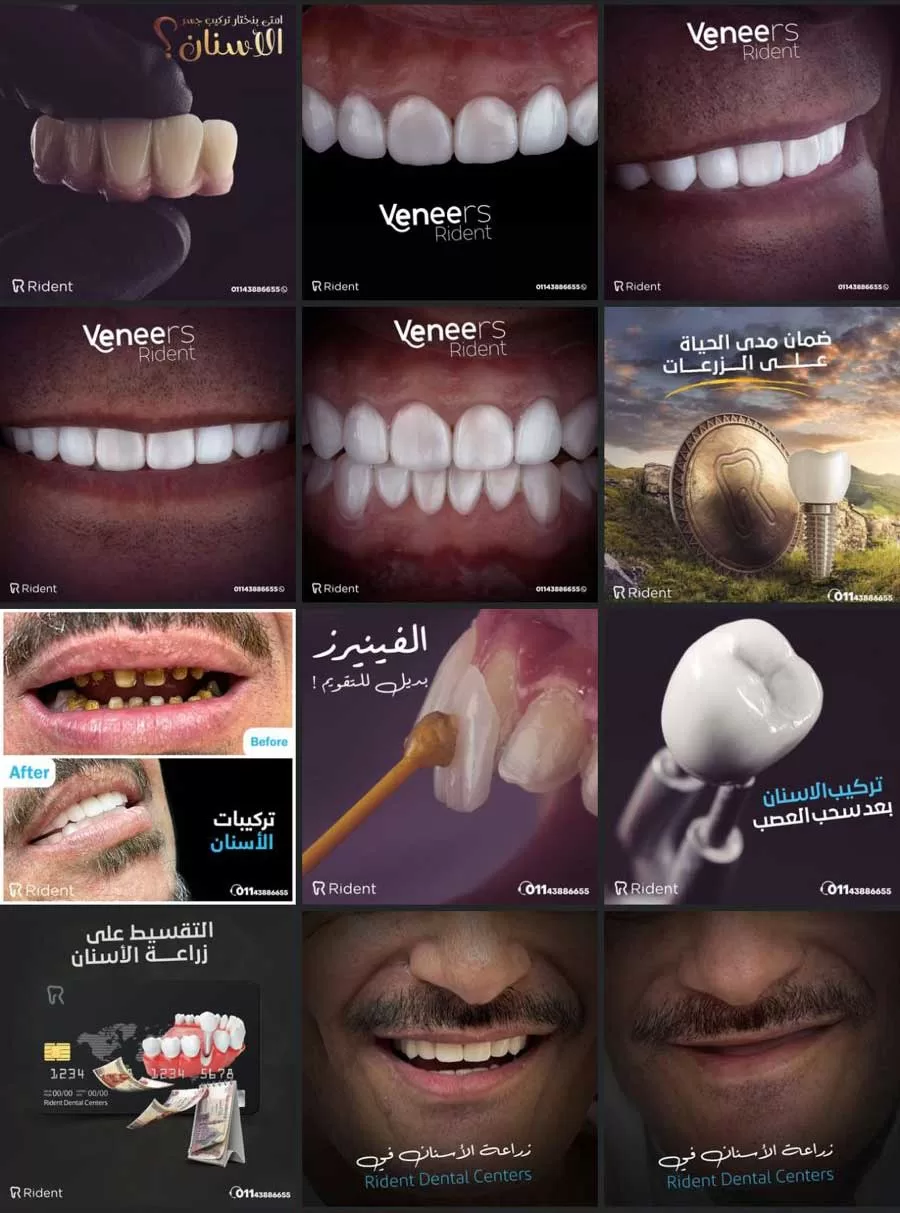 rident dental centers social media posts